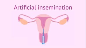 Read more about the article Artificial Insemination