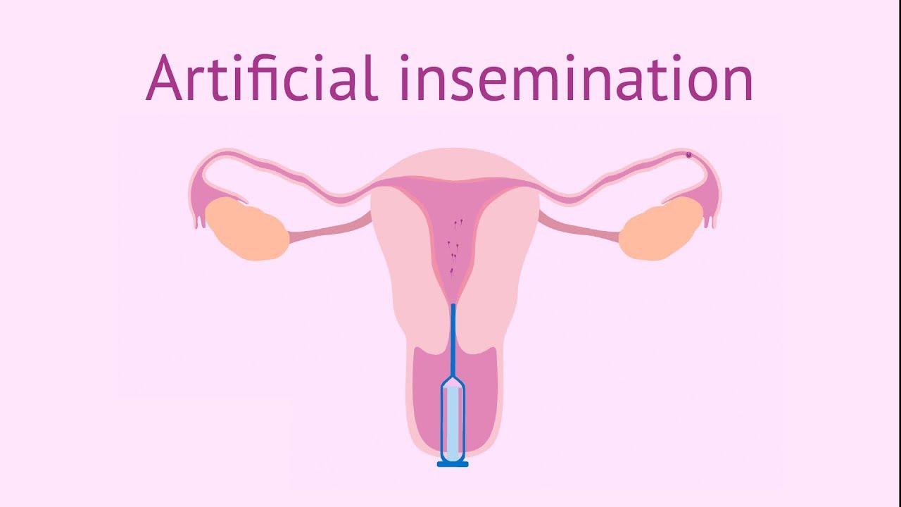 You are currently viewing Artificial Insemination