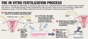 Read more about the article IVF Procedure