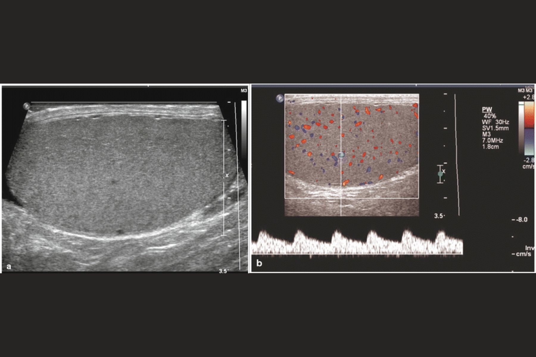 Read more about the article Ultrasonography